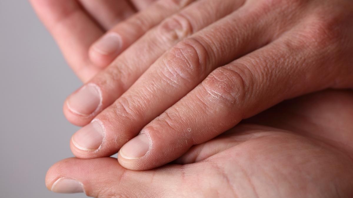 Ce dezvaluie unghiile despre sanatatea ta